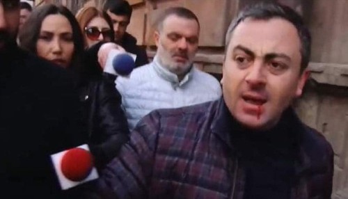 Թուրքի լամուկներն ու բոլորը պատասխա՛ն են տալու