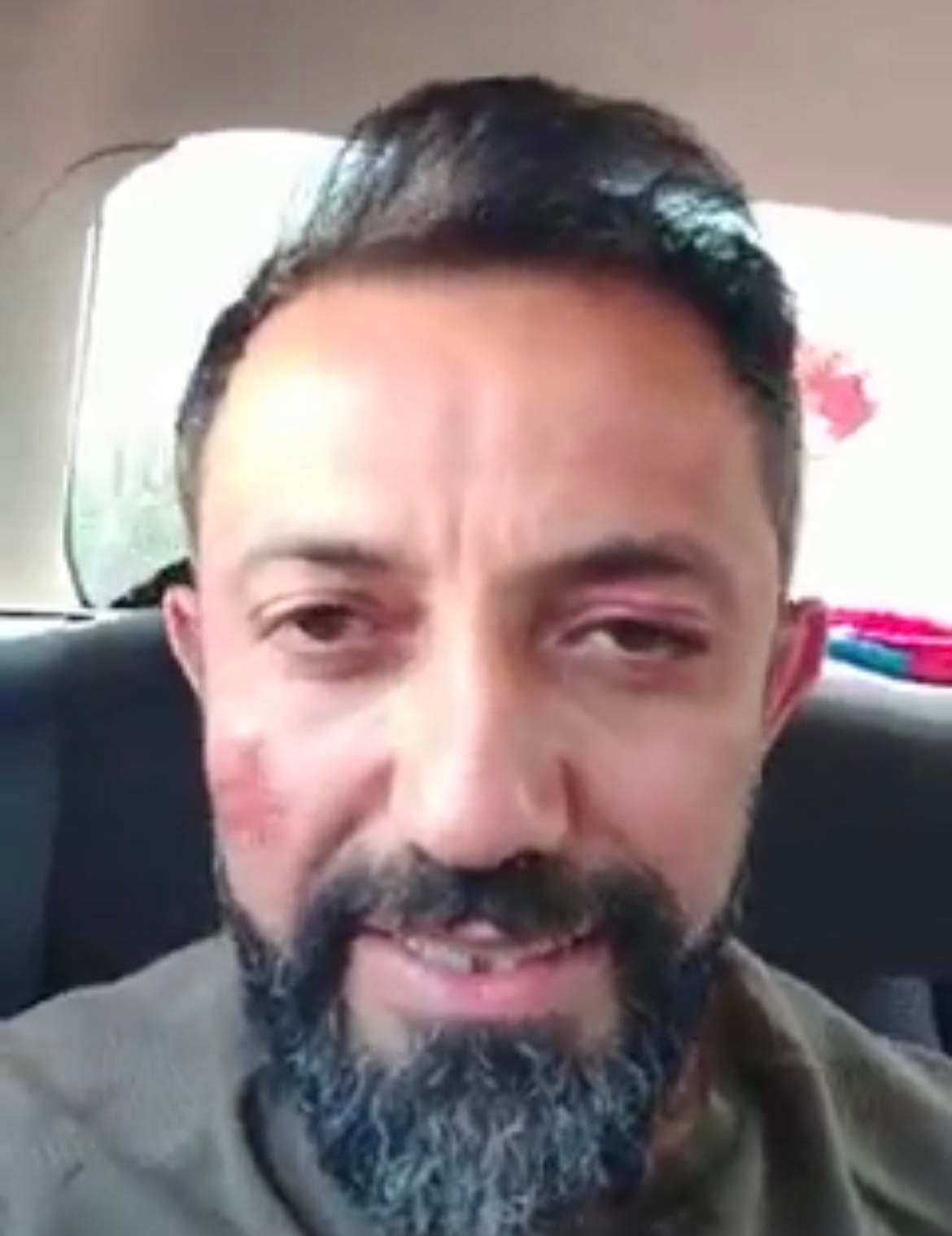 Դերասանին բերման ենթարկելու ժամանակ ոստիկանները հարվածել են դեմքին, աչքին, գլխին