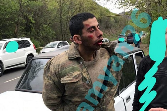 «Քիչ առաջ ձերբակալված ադրբեջանցին»