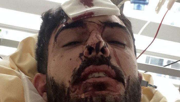 «Եթե Ալիևը փորձում է գլխատել սեփական քաղաքացուն, ինչպե՞ս կարող է երաշխավորել հայերի անվտանգությունը Ղարաբաղում»․ ադրբեջանցի բլոգեր