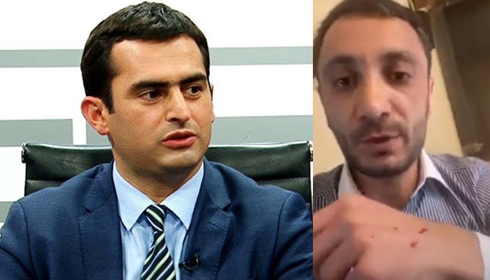 Ներողություն եմ խնդրում նաև լրագրողական հանրույթից և կոնկրետ Փայլակից. Հակոբ Արշակյանը՝ սկանդալային միջադեպի մասին