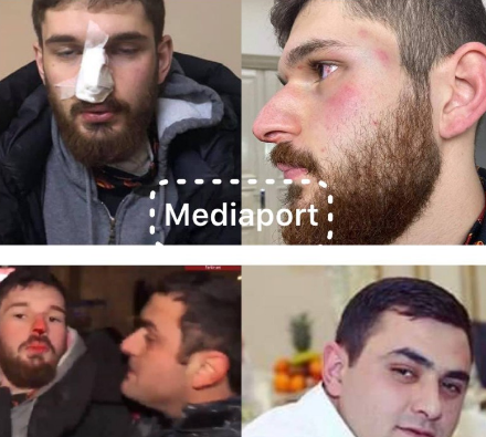 Հայտնի է Փաշինյանի հրաժարականը պահանջող երիտասարդ տղային դաժան ծեծի ենթարկած ոստիկանի ինքնությունը. ով է նա